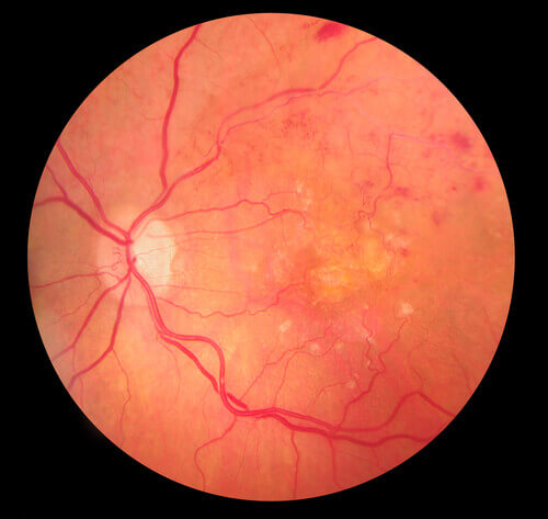 close up of the retina